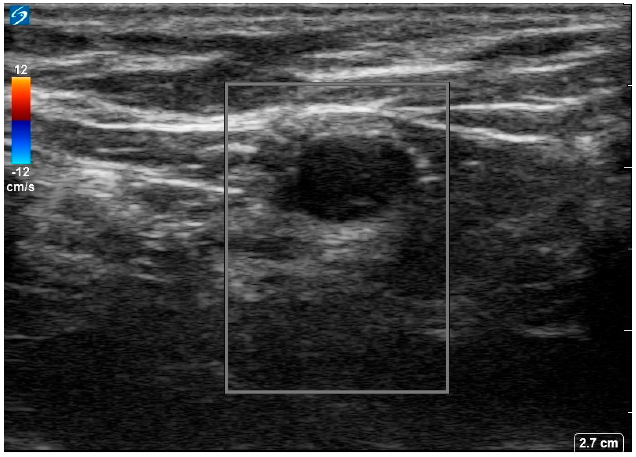 Curroncol 32 00440 g002 Curroncol 32 00440 g002
