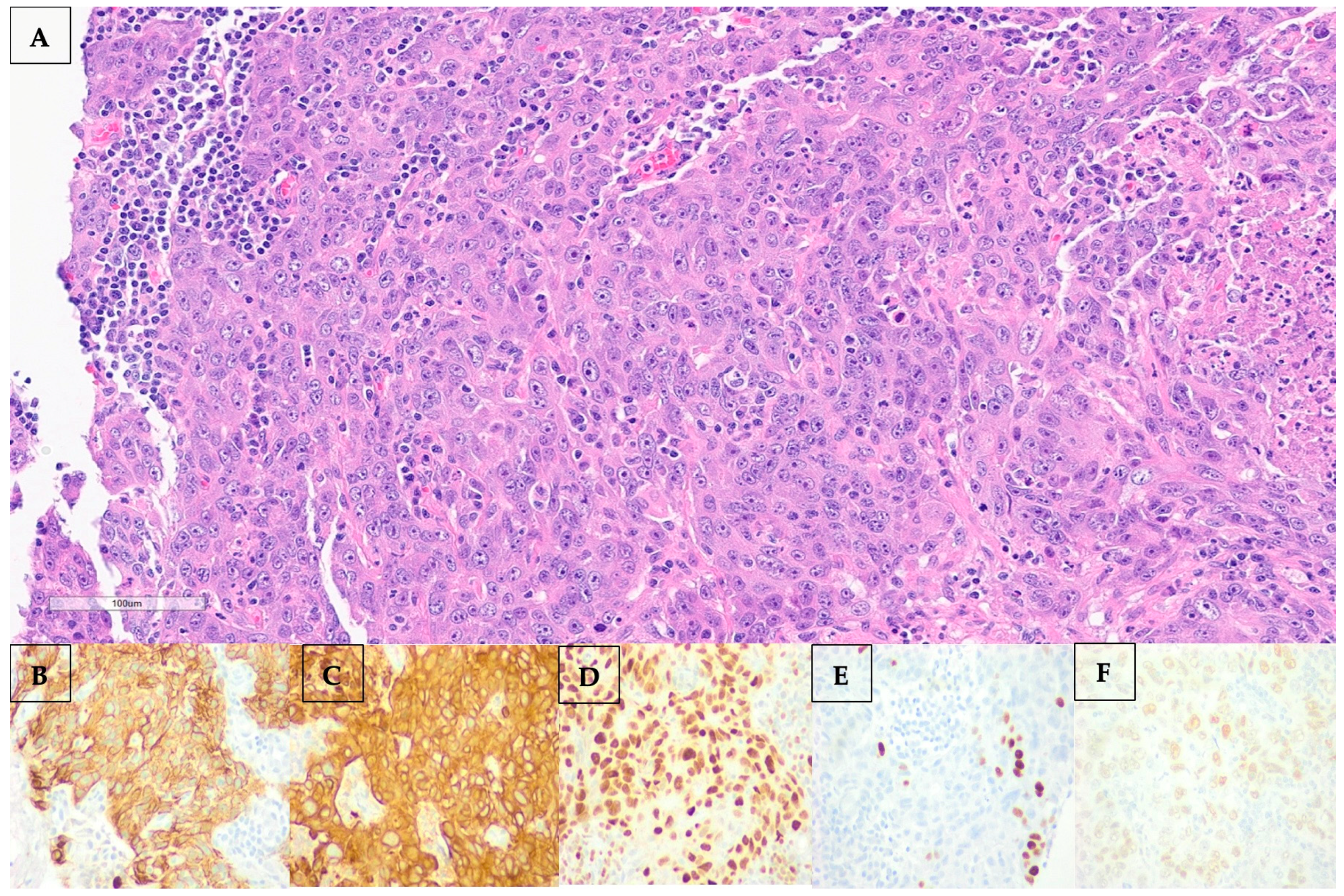 Curroncol 32 00440 g003 Curroncol 32 00440 g003