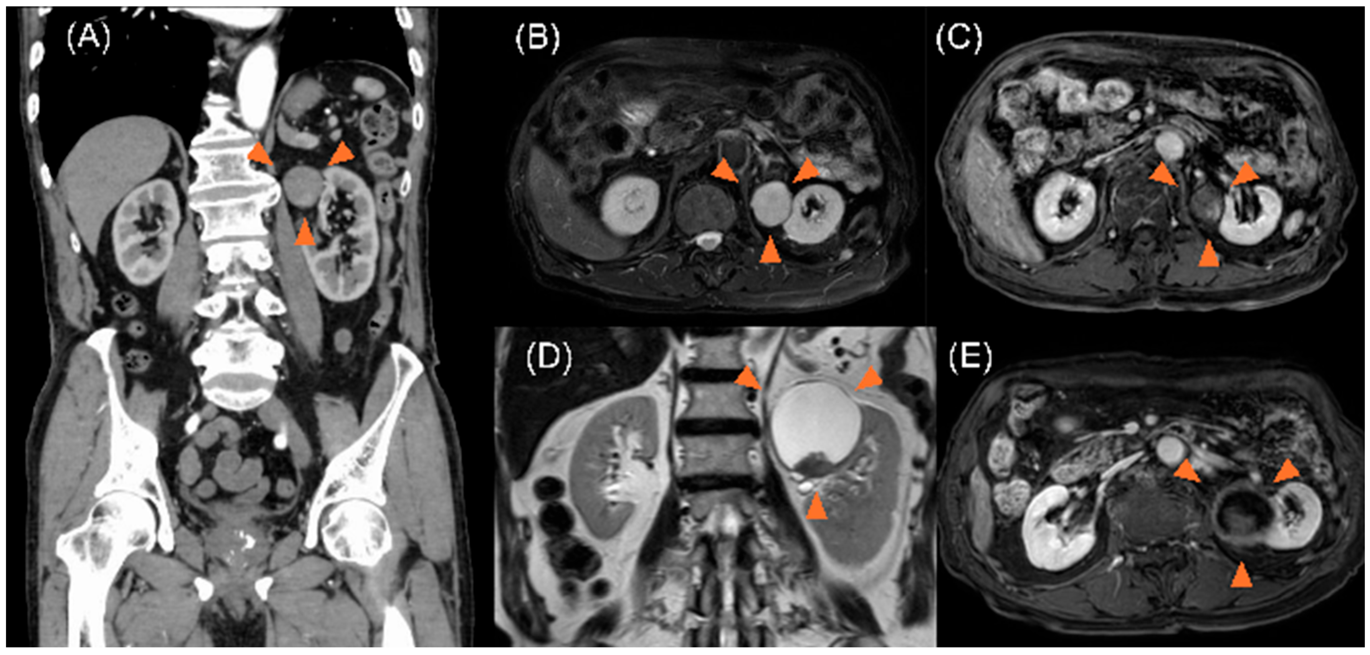 Curroncol 32 00500 g001