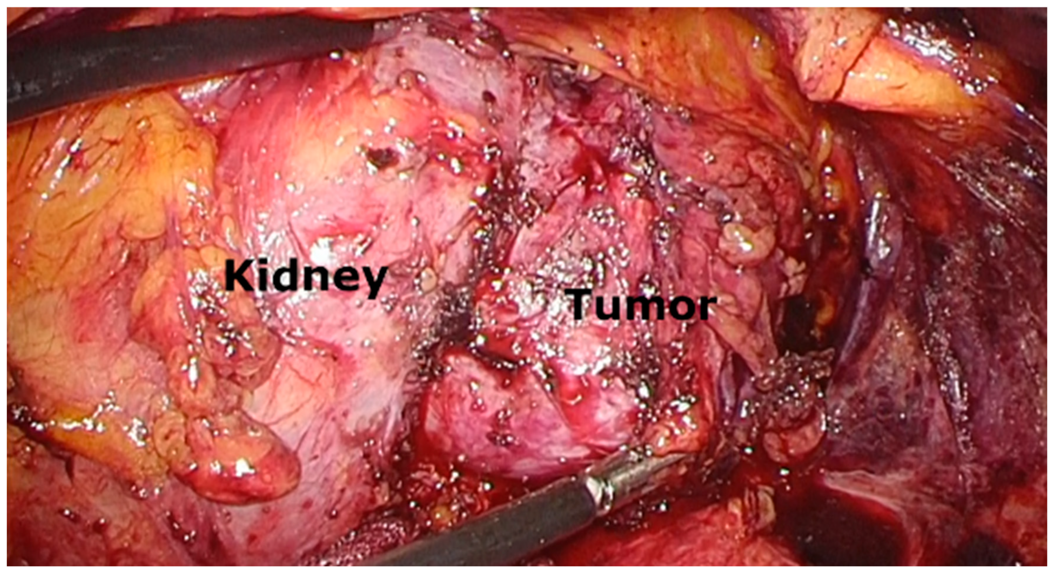 Curroncol 32 00500 g002