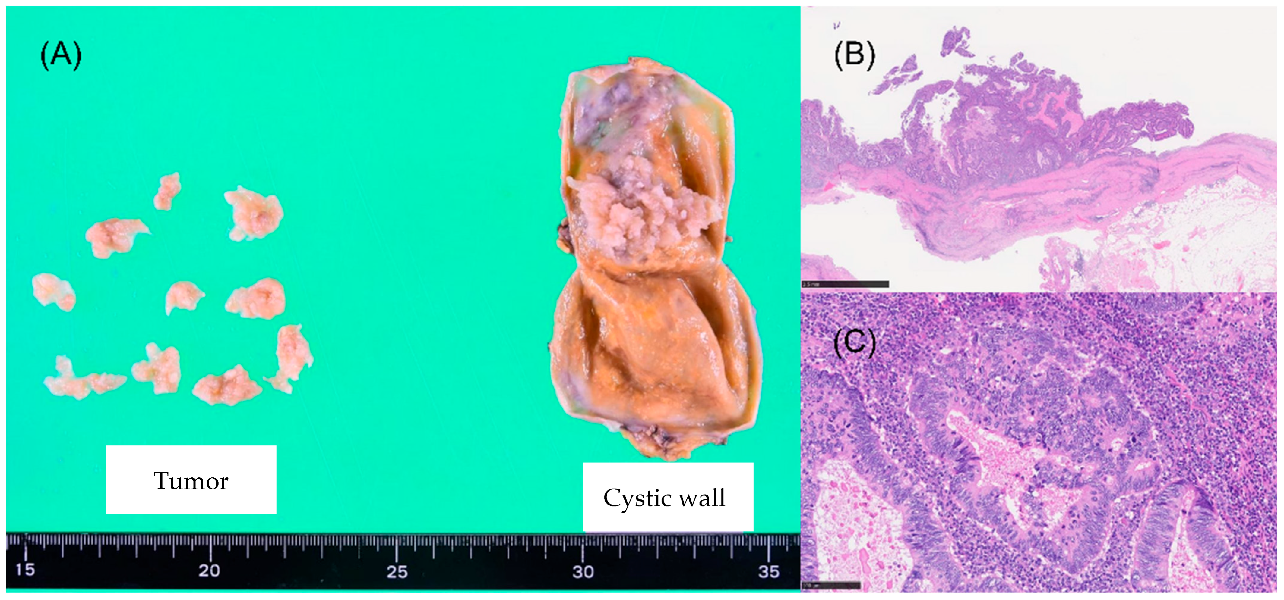 Curroncol 32 00500 g003