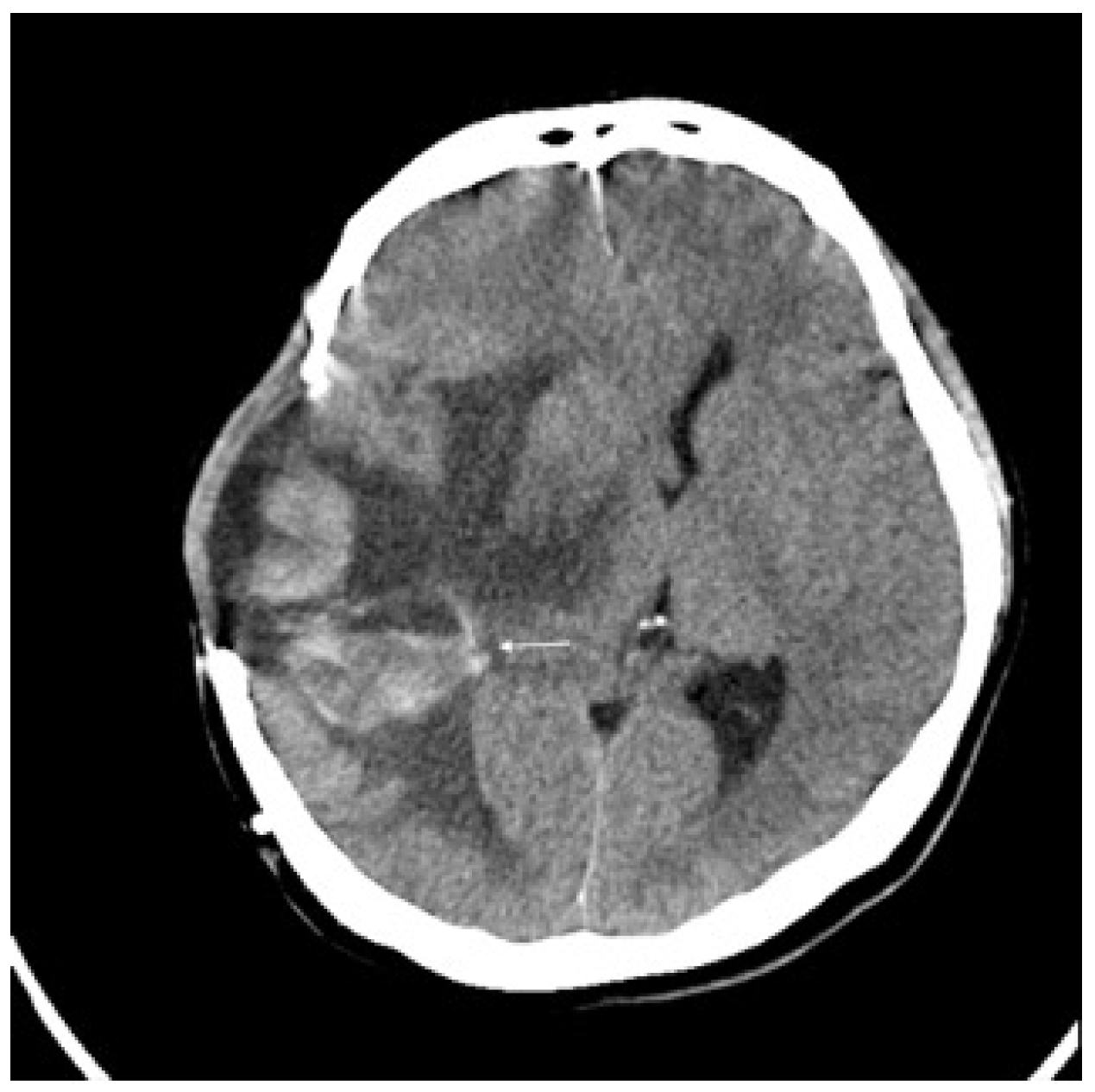 Curroncol 32 00595 g003