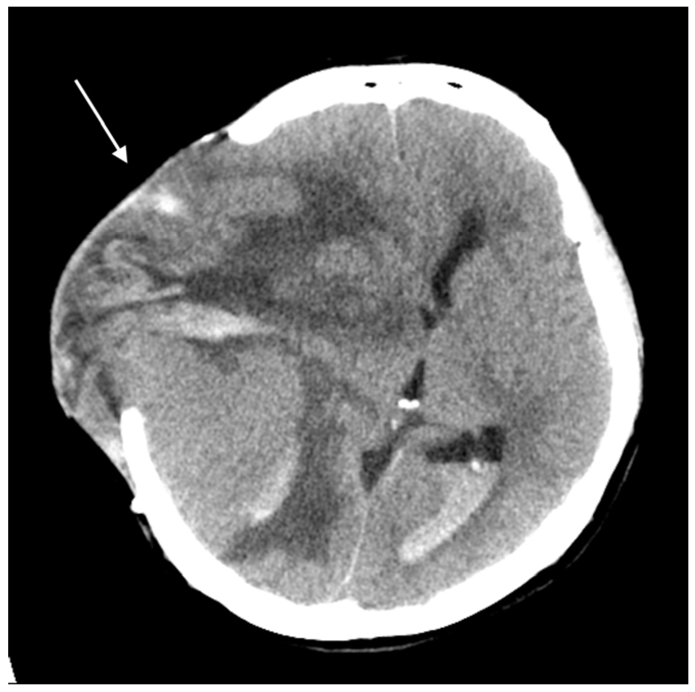 Curroncol 32 00595 g004