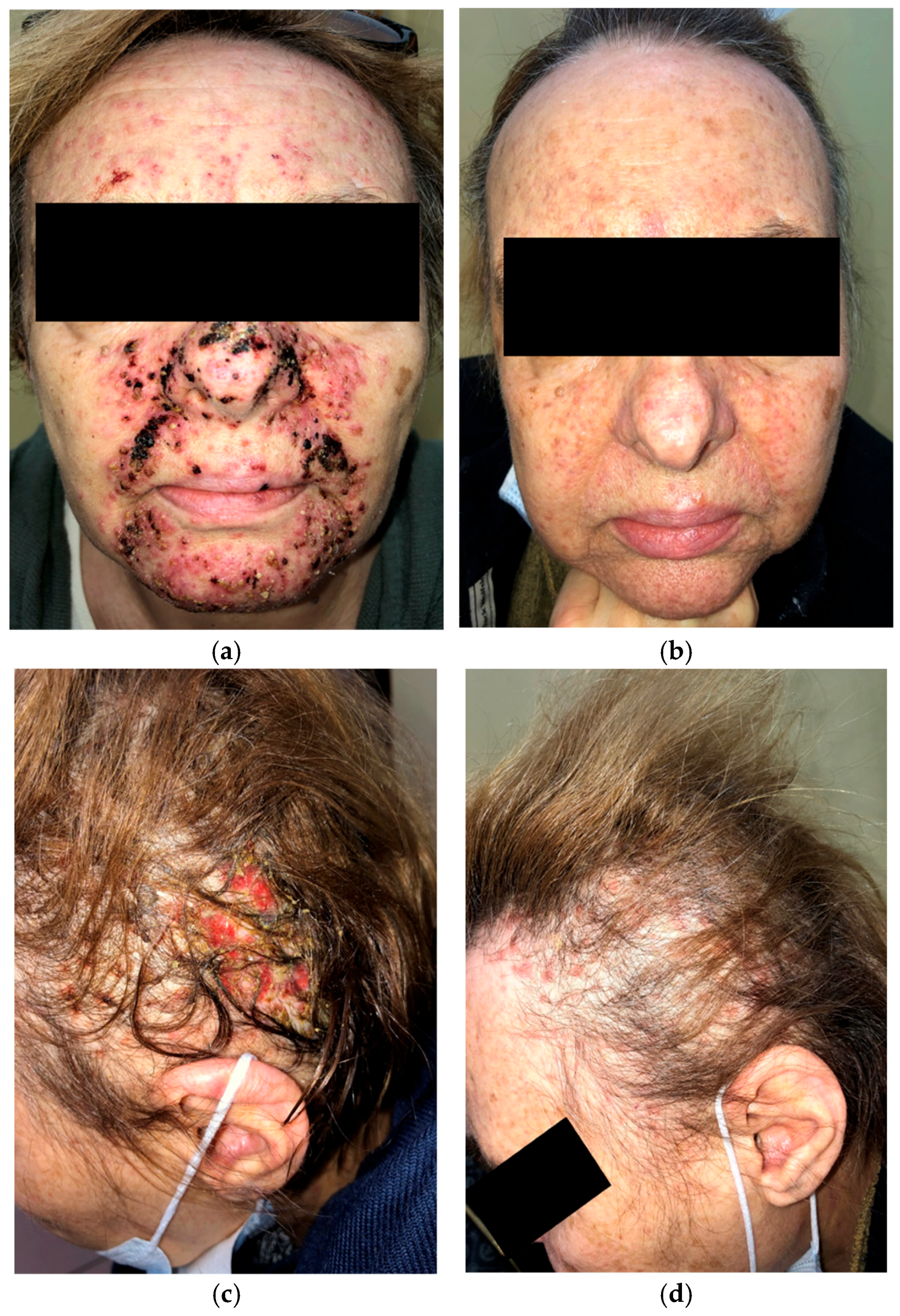 Curroncol 33 00096 g003