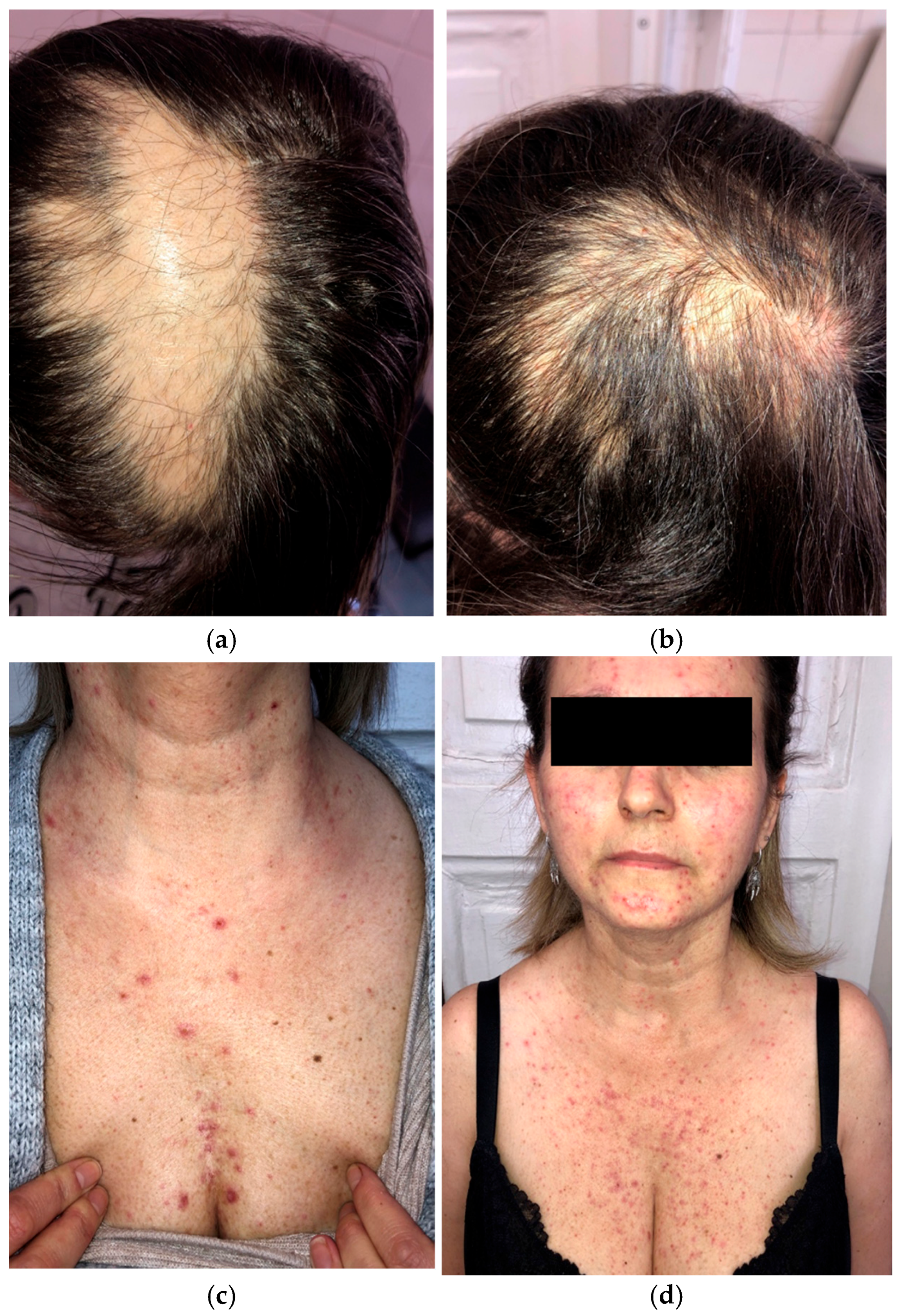 Curroncol 33 00096 g004