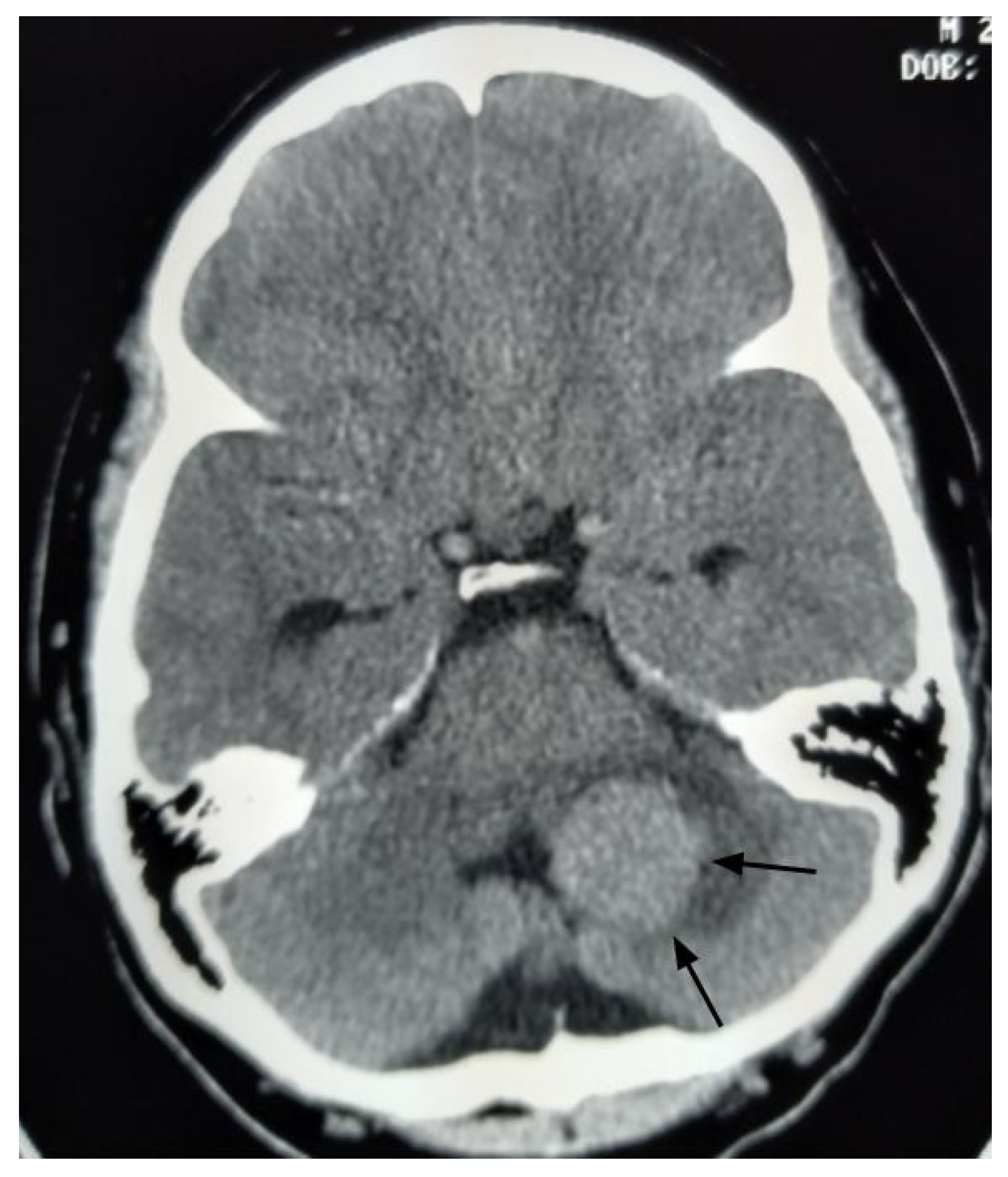 Curroncol 33 00114 g002 Curroncol 33 00114 g002