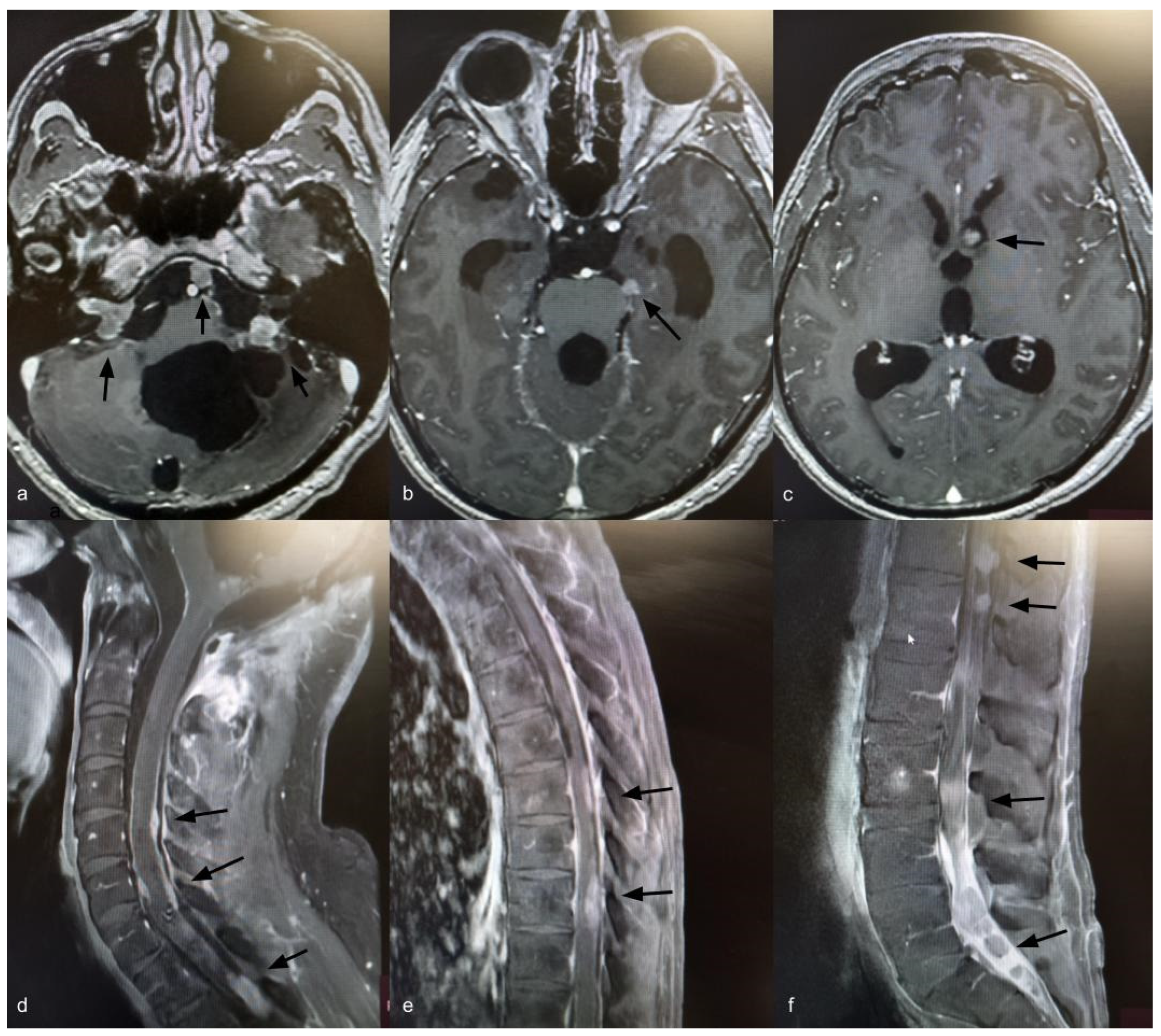 Curroncol 33 00114 g003 Curroncol 33 00114 g003