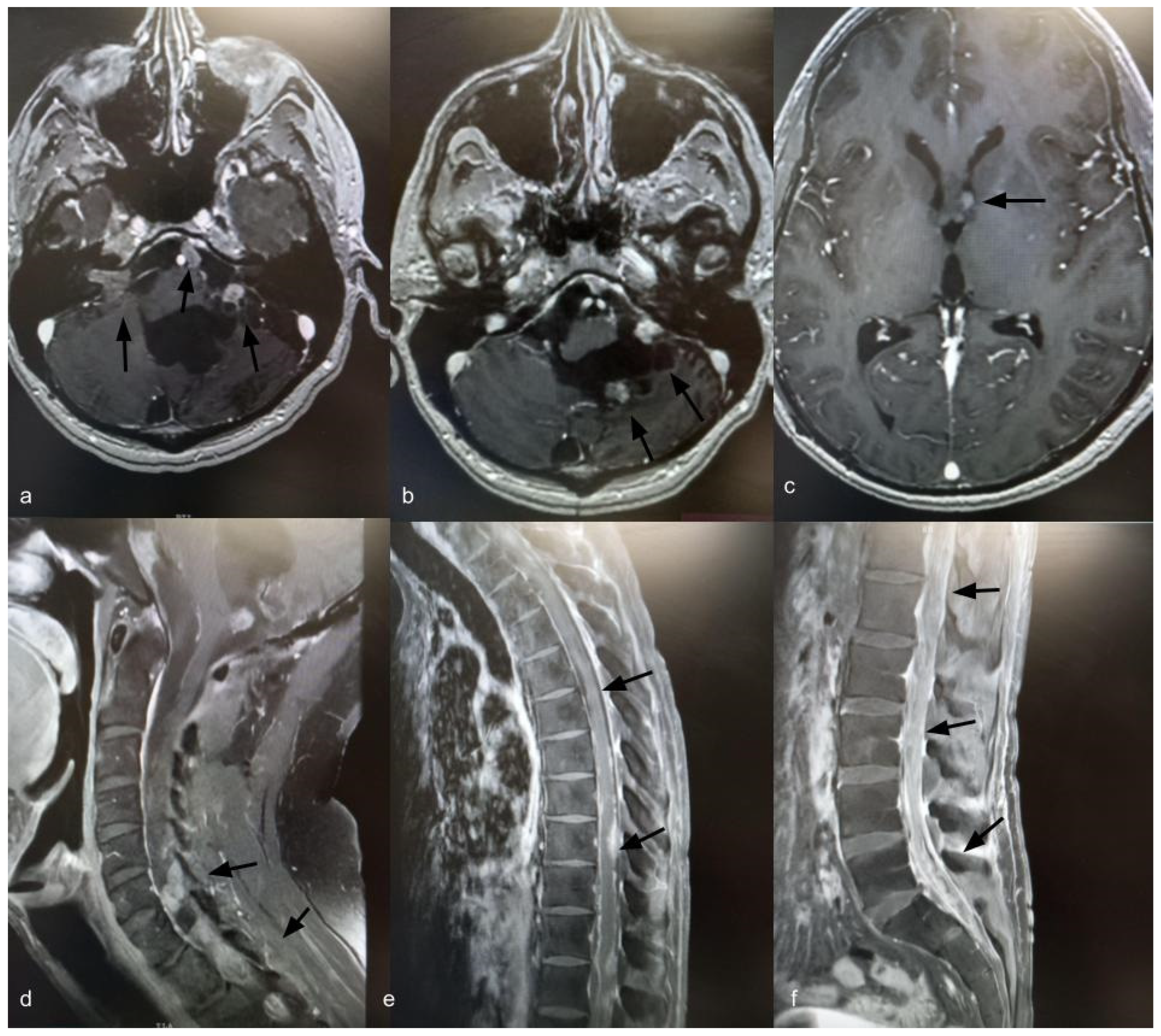 Curroncol 33 00114 g004 Curroncol 33 00114 g004