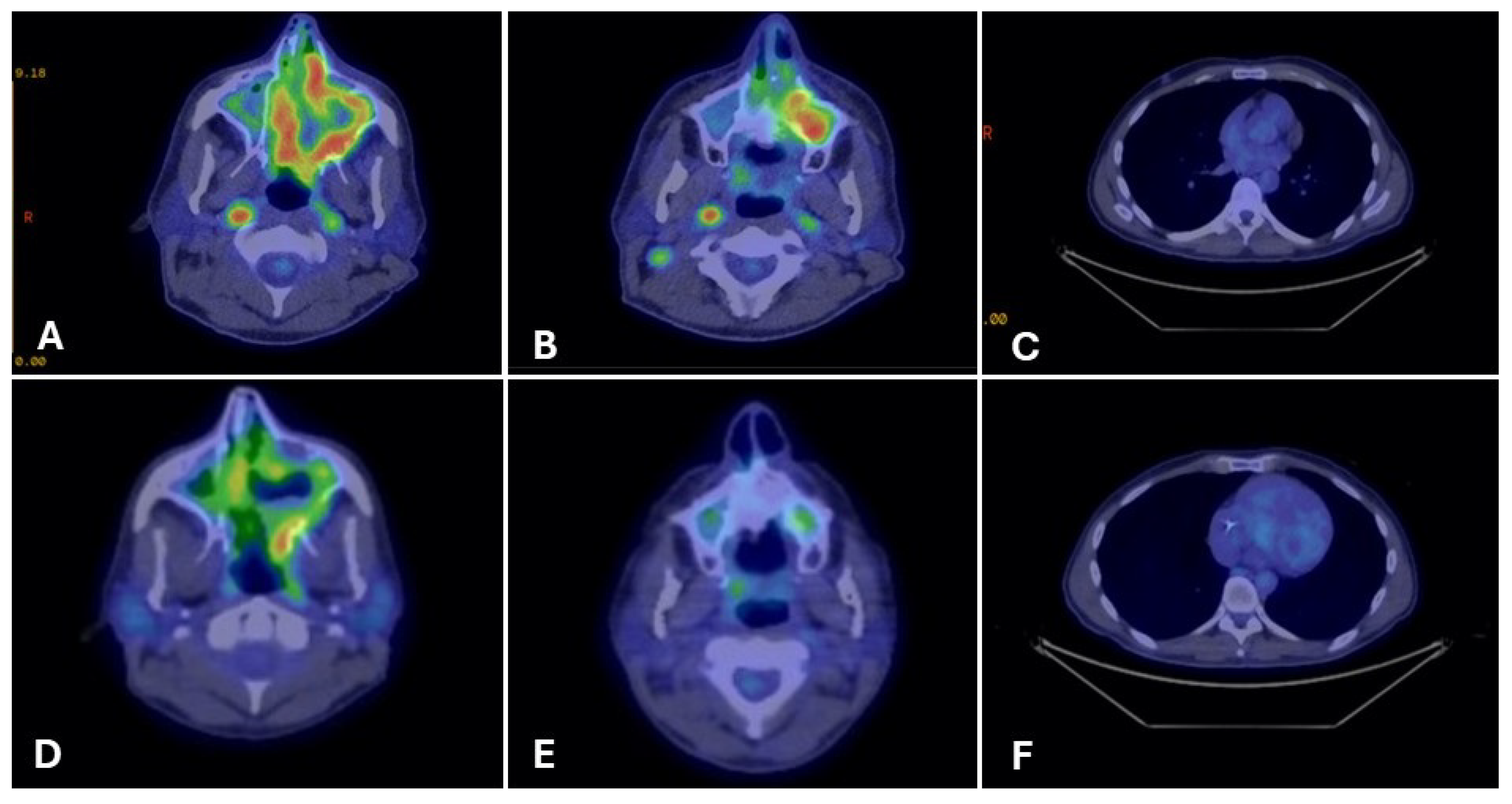 Curroncol 33 00126 g004