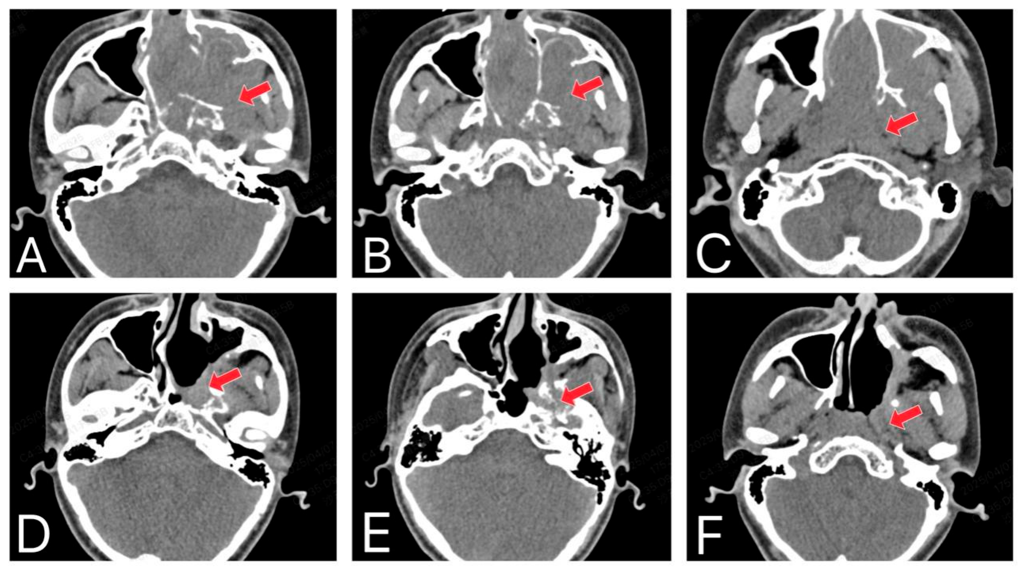 Curroncol 33 00147 g002