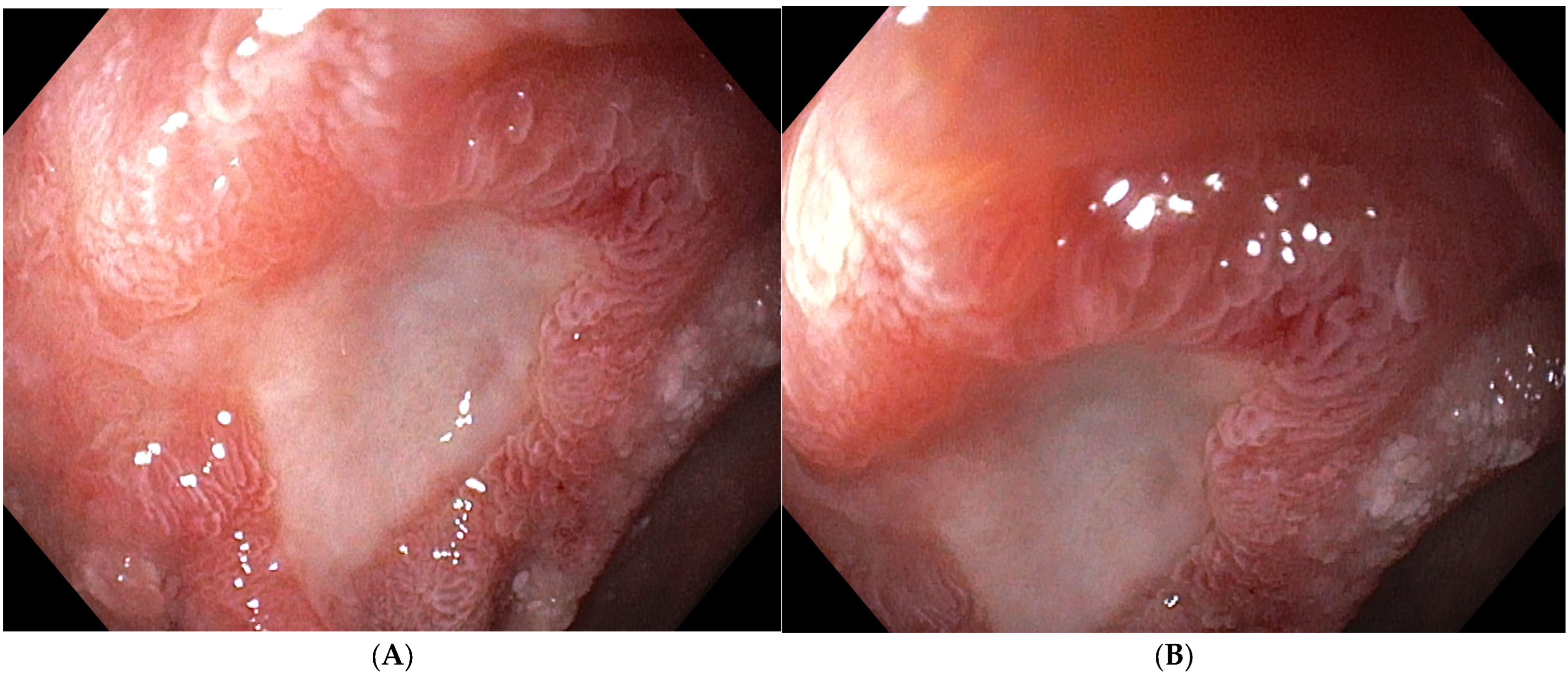 Curroncol 33 00459 g002 Curroncol 33 00459 g002