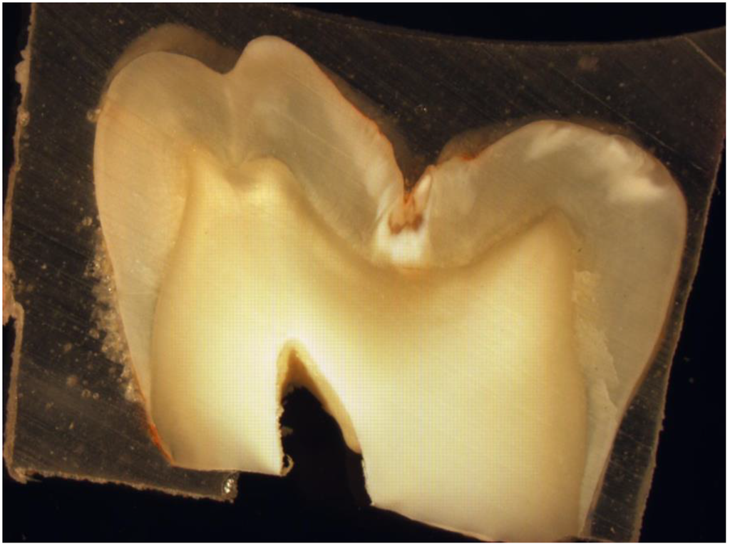 Dentistry 01 00019 g002 1024