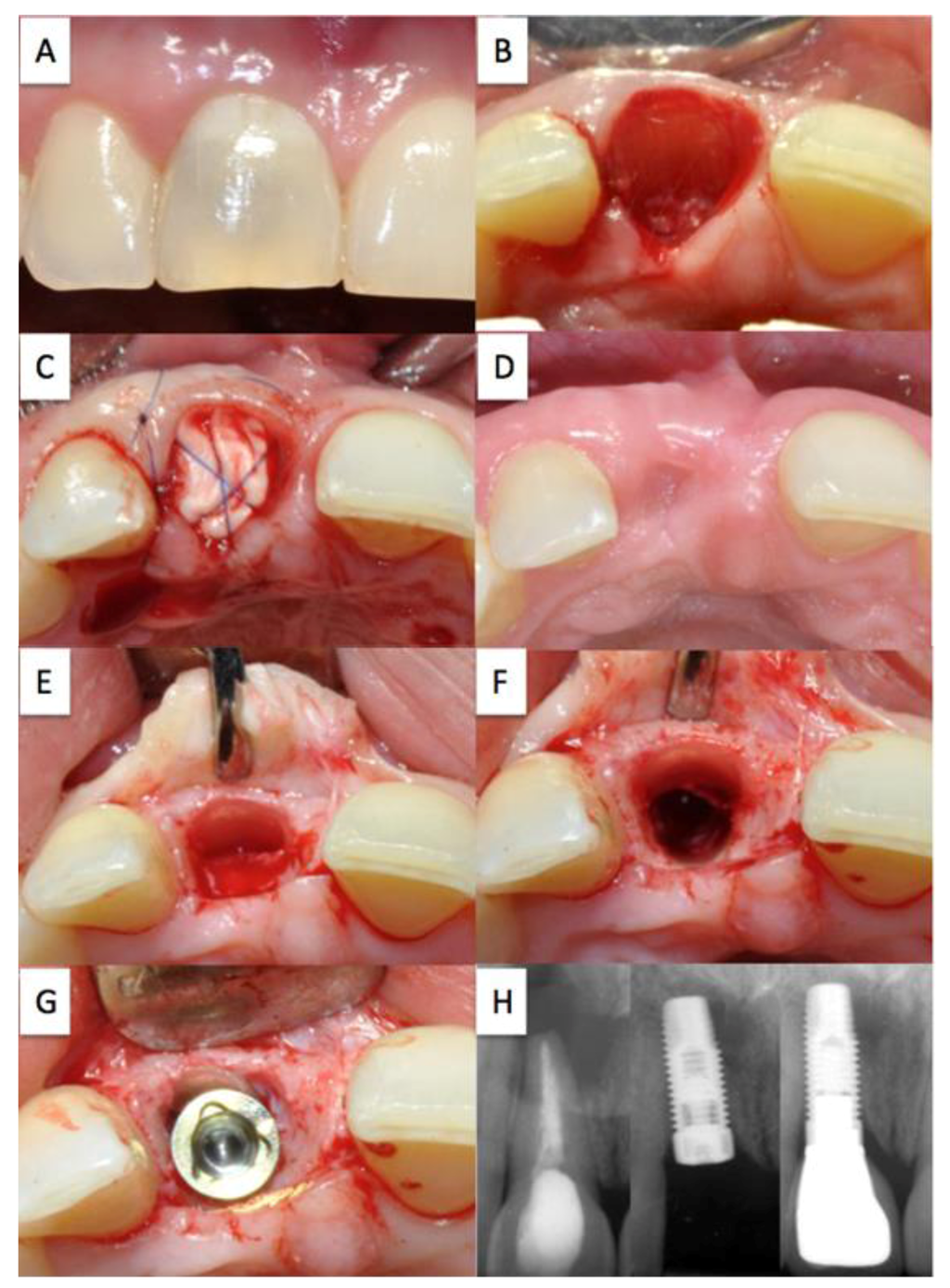 Dentistry 02 00011 g003 1024