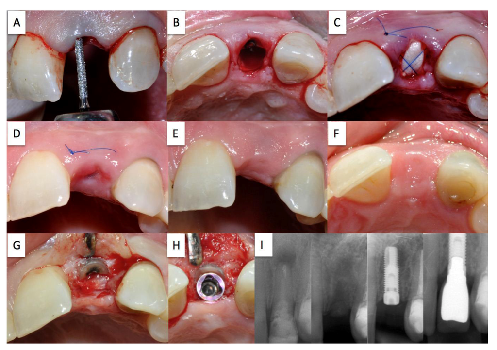 Dentistry 02 00011 g004 1024
