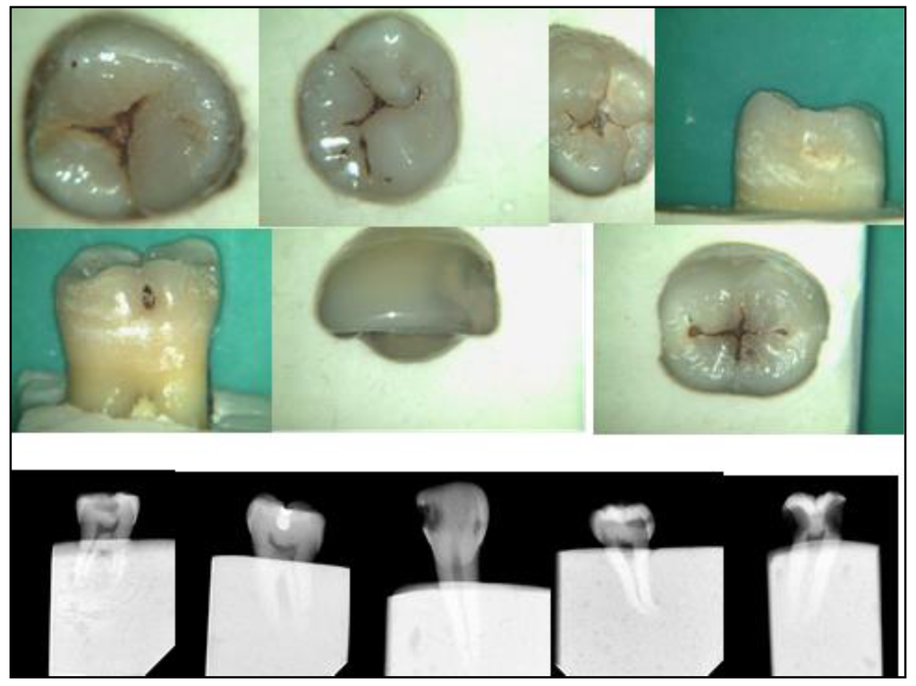 Dentistry 02 00041 g002 1024