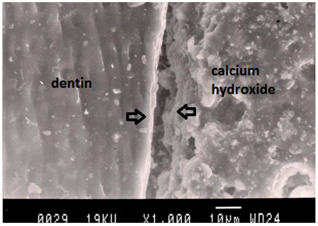 Dentistry 02 00052 g003 1024