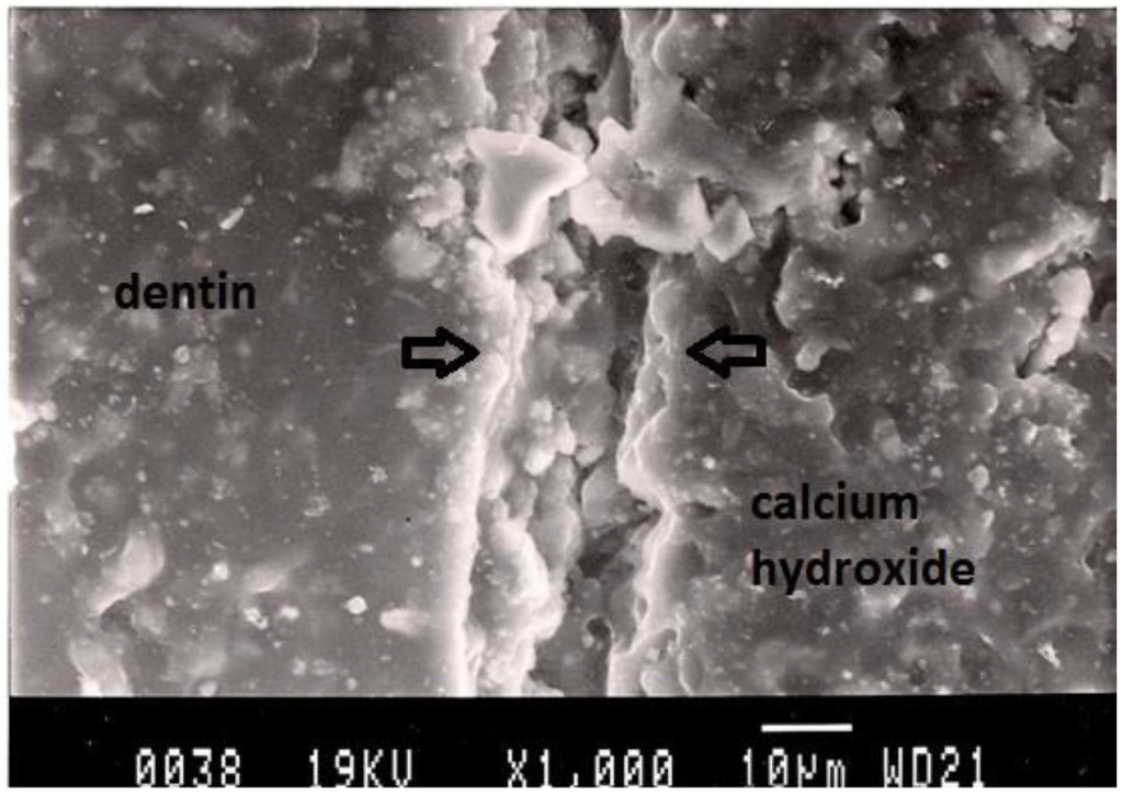 Dentistry 02 00052 g004 1024