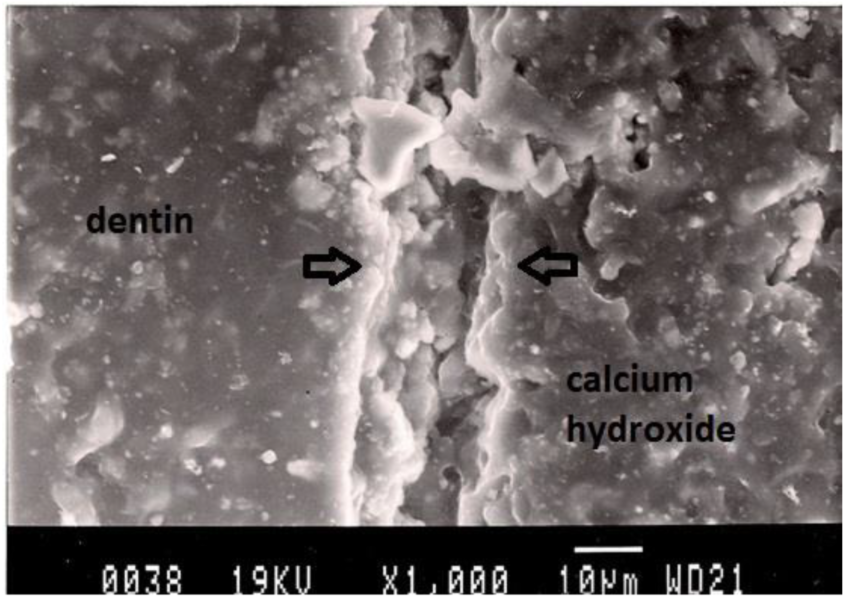 Dentistry 02 00052 g004