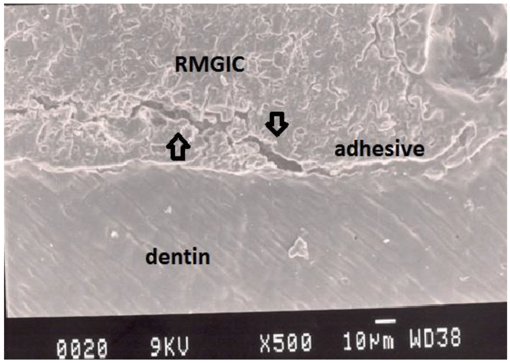 Dentistry 02 00052 g006 1024