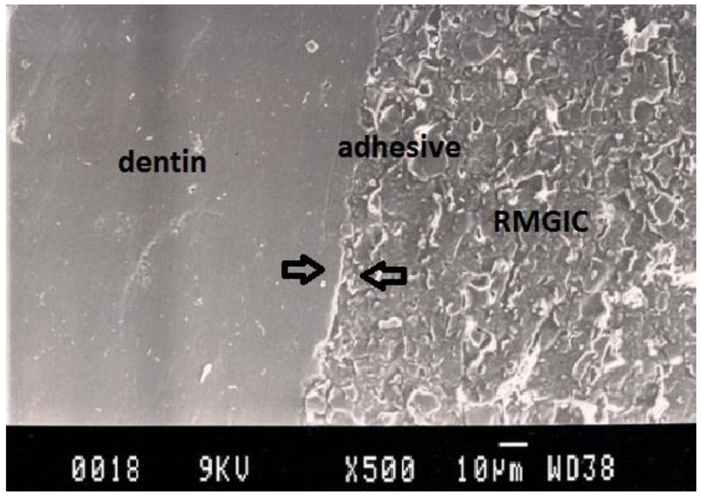 Dentistry 02 00052 g007 1024