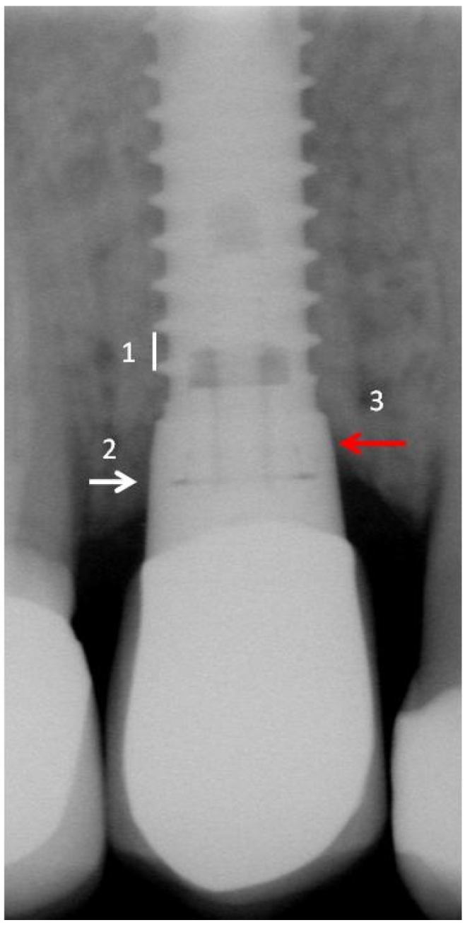 Dentistry 02 00106 g001