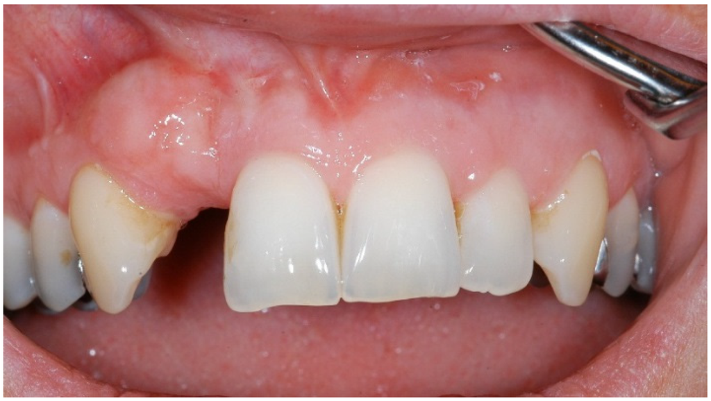 Dentistry 02 00106 g004 1024