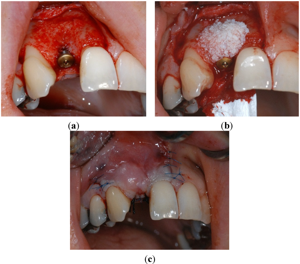 Dentistry 02 00106 g005 1024