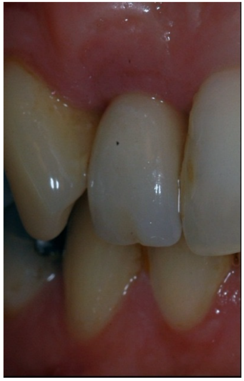 Dentistry 02 00106 g006 1024