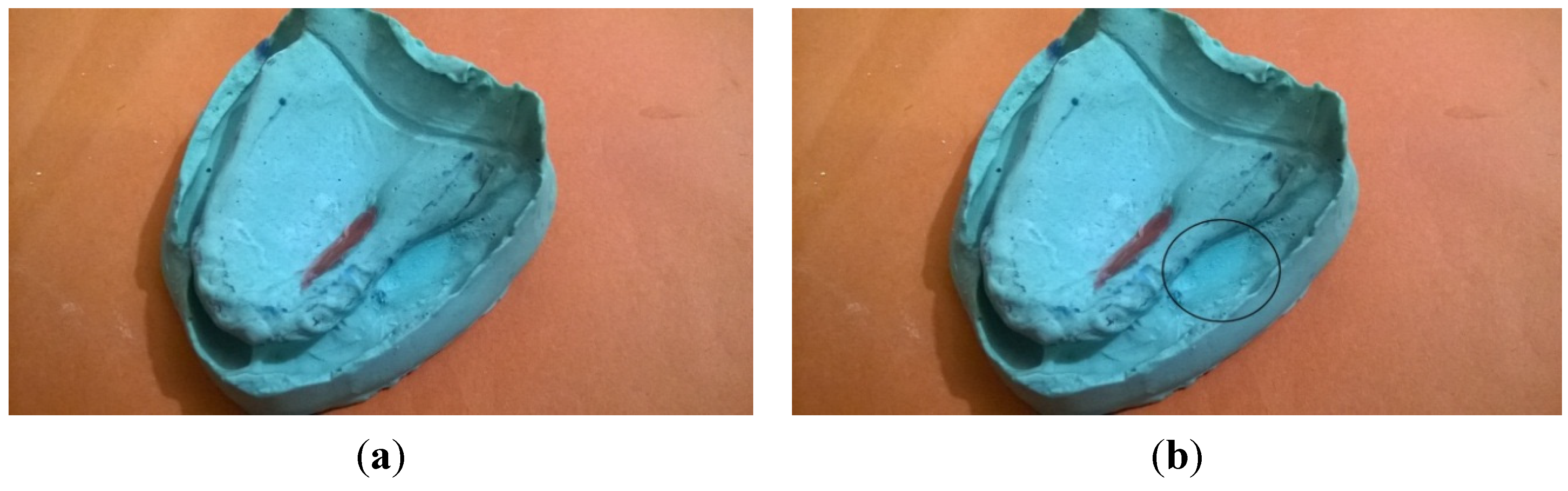 Dentistry 02 00142 g004