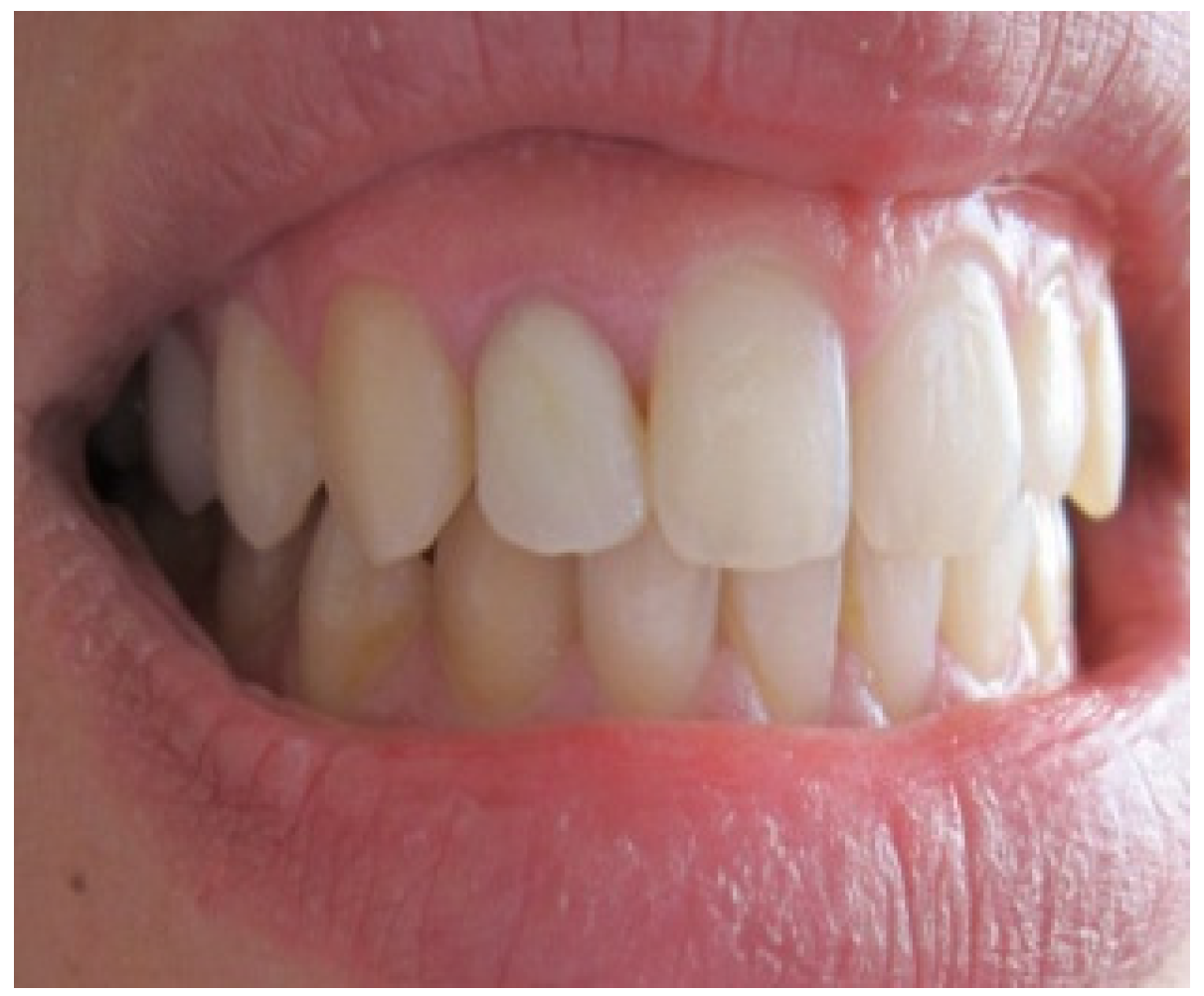 Dentistry 02 00155 g001