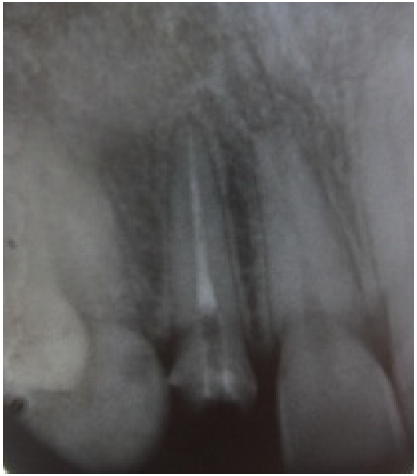 Dentistry 02 00155 g003