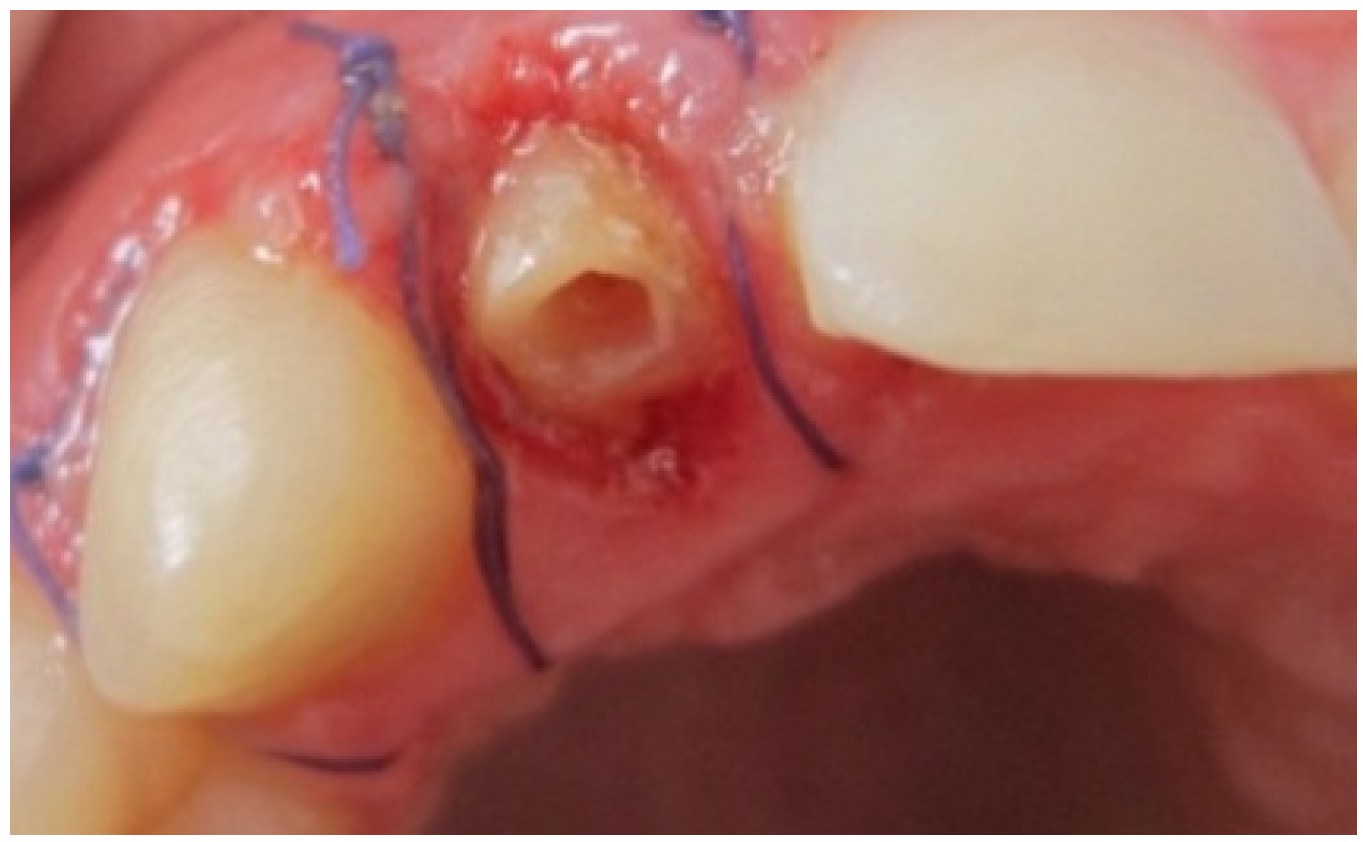 Dentistry 02 00155 g004