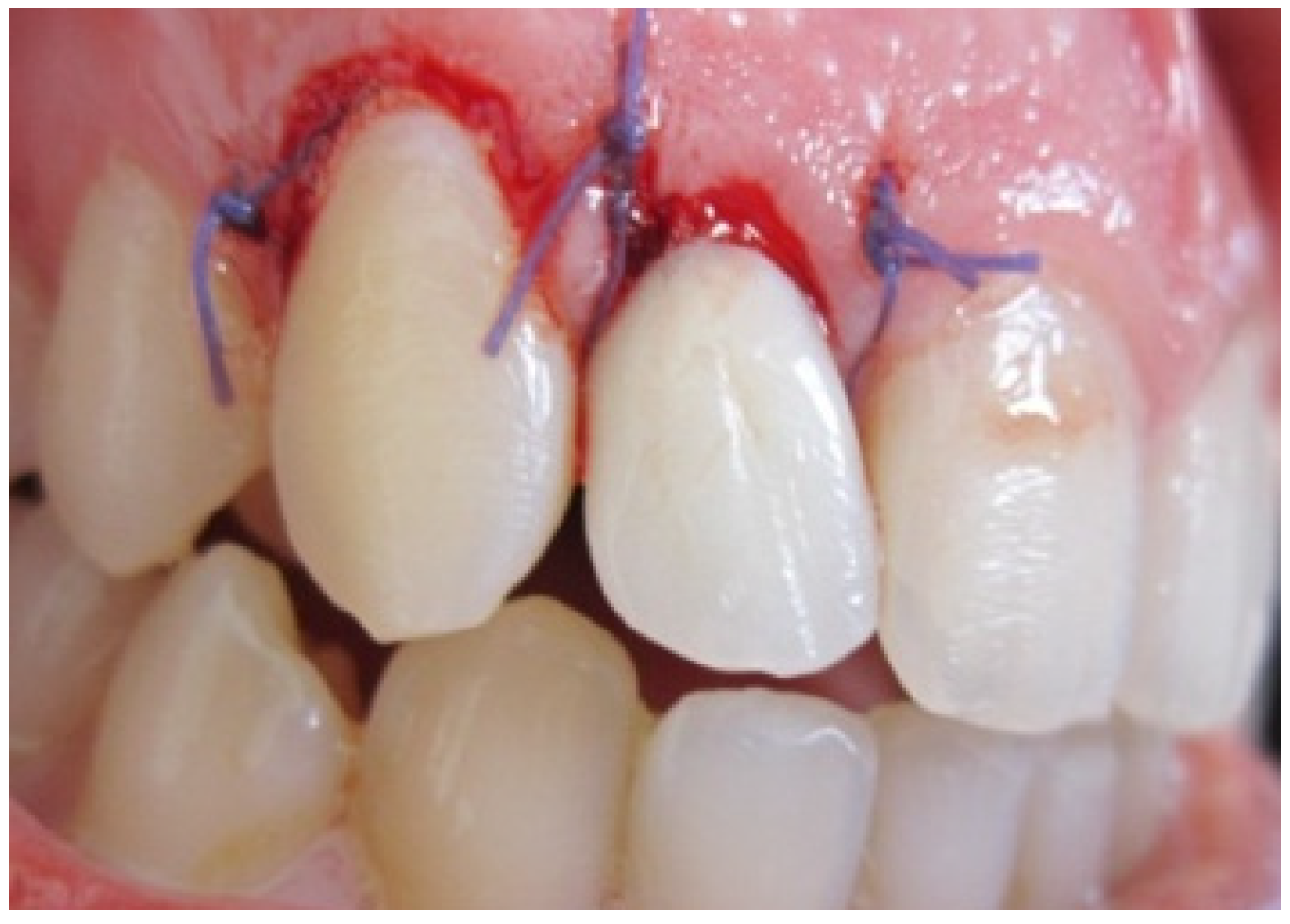 Dentistry 02 00155 g005