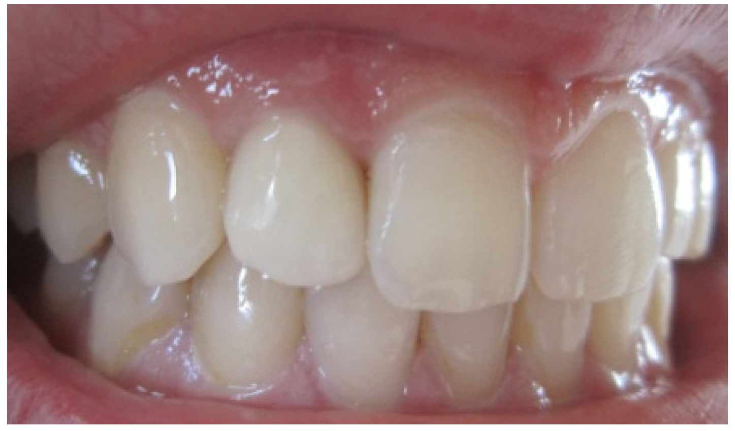 Dentistry 02 00155 g007