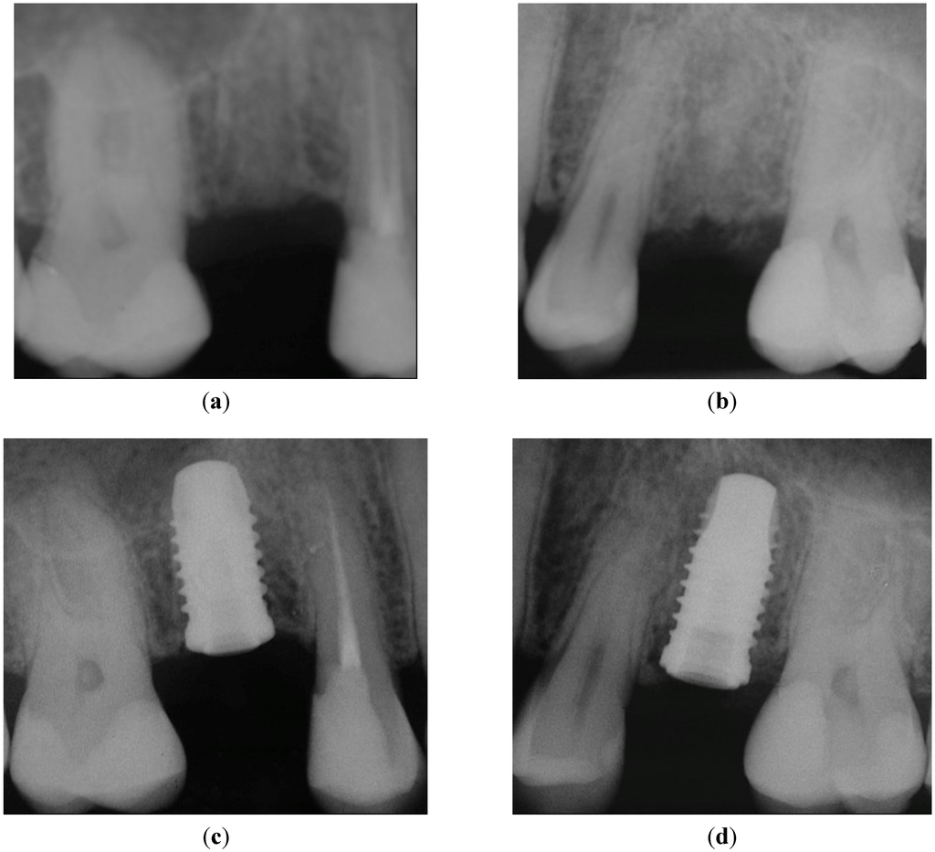 Dentistry 03 00055 g004 1024