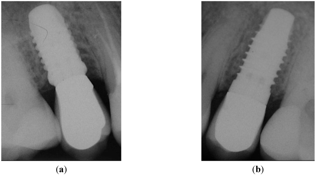 Dentistry 03 00055 g005 1024