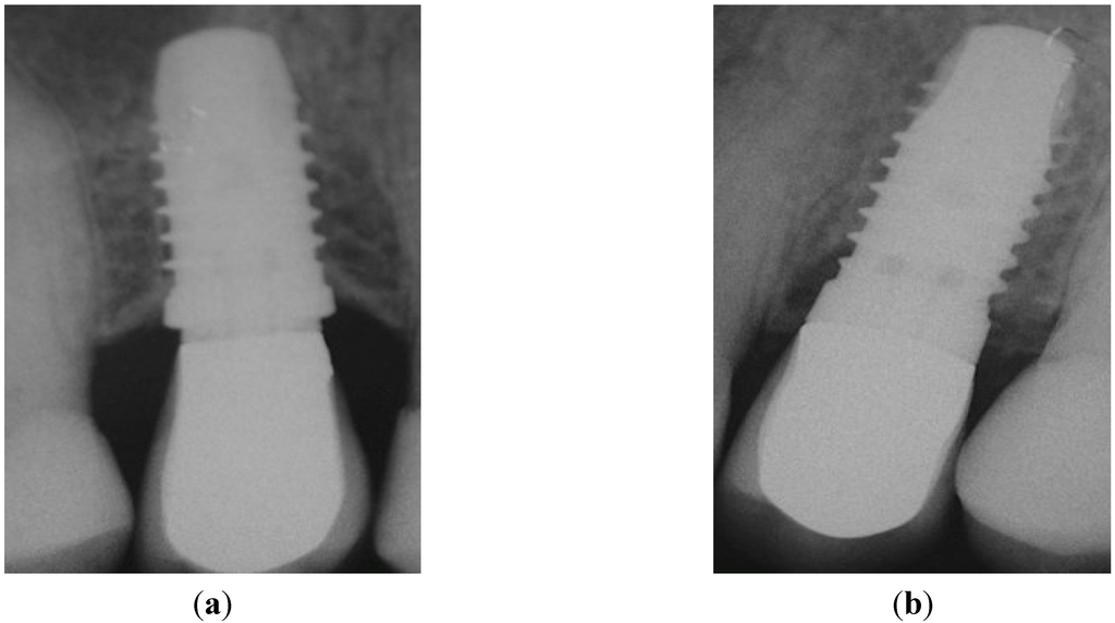 Dentistry 03 00055 g006 1024