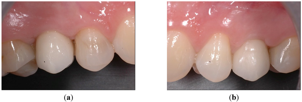 Dentistry 03 00055 g007a 1024