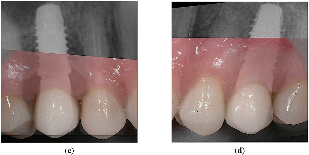 Dentistry 03 00055 g007b 1024