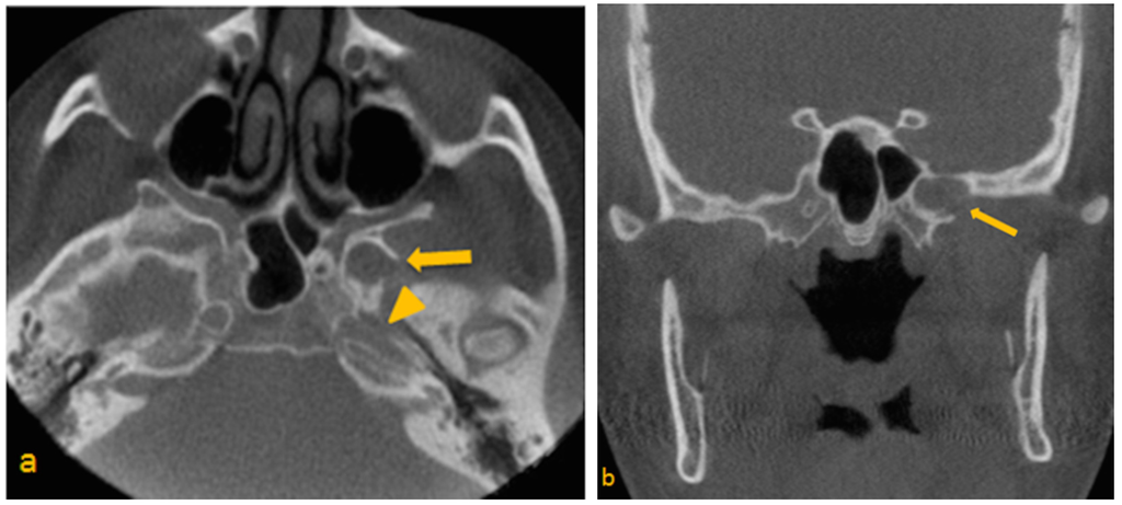 Dentistry 03 00067 g001a 1024
