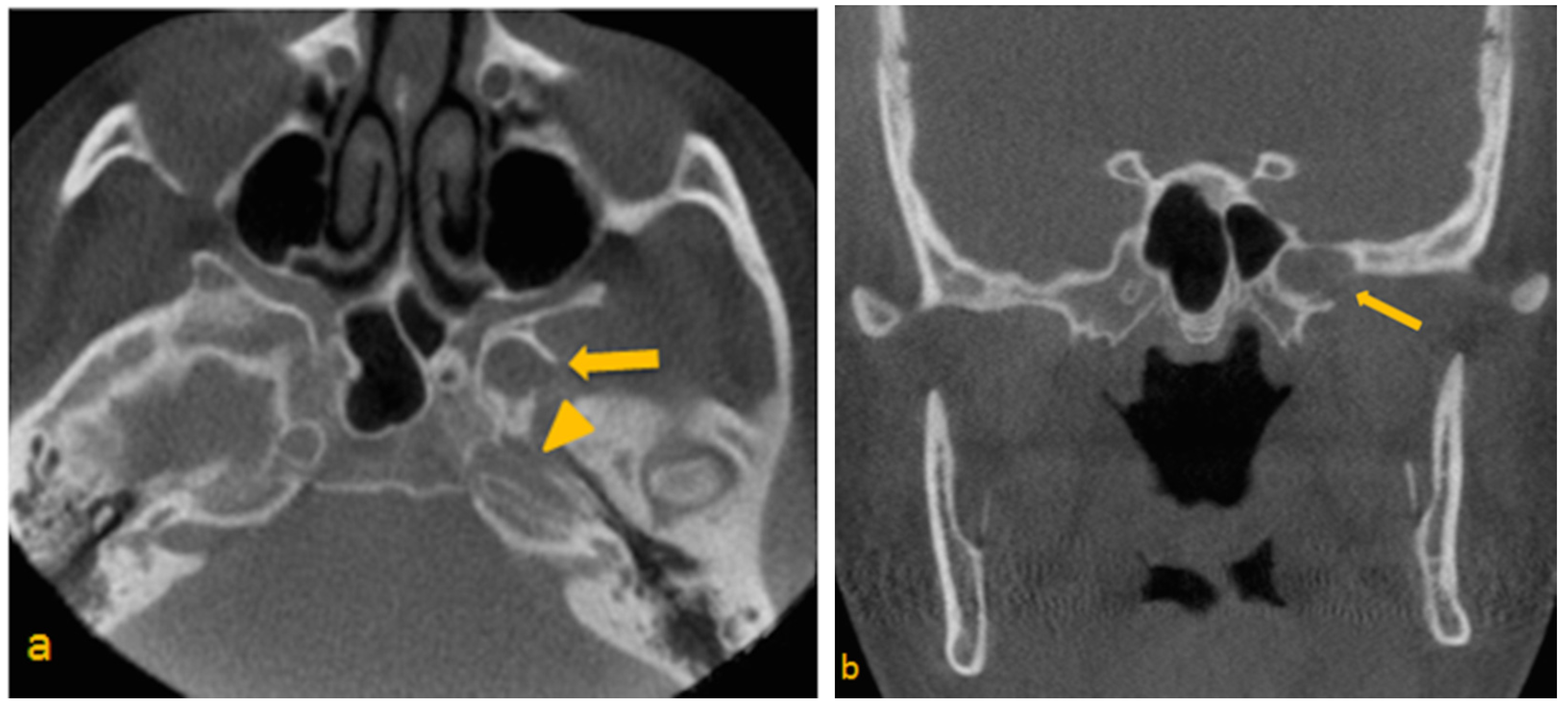 Dentistry 03 00067 g001a