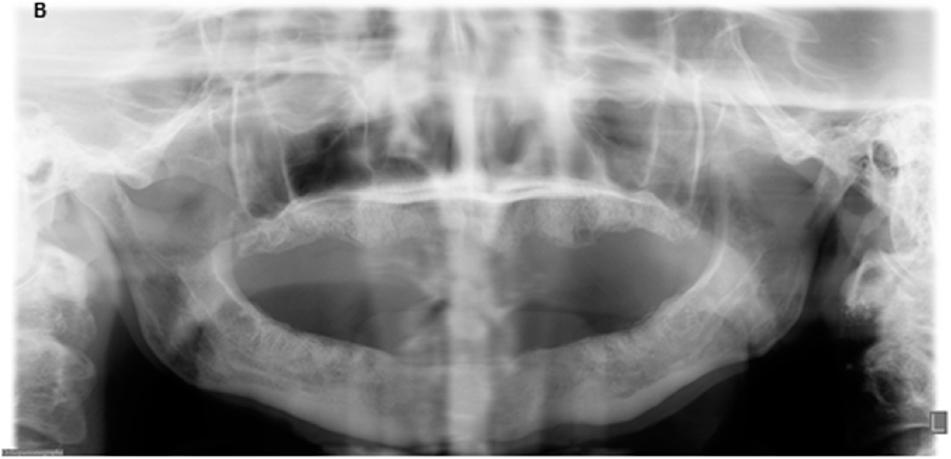 Dentistry 04 00009 g002b