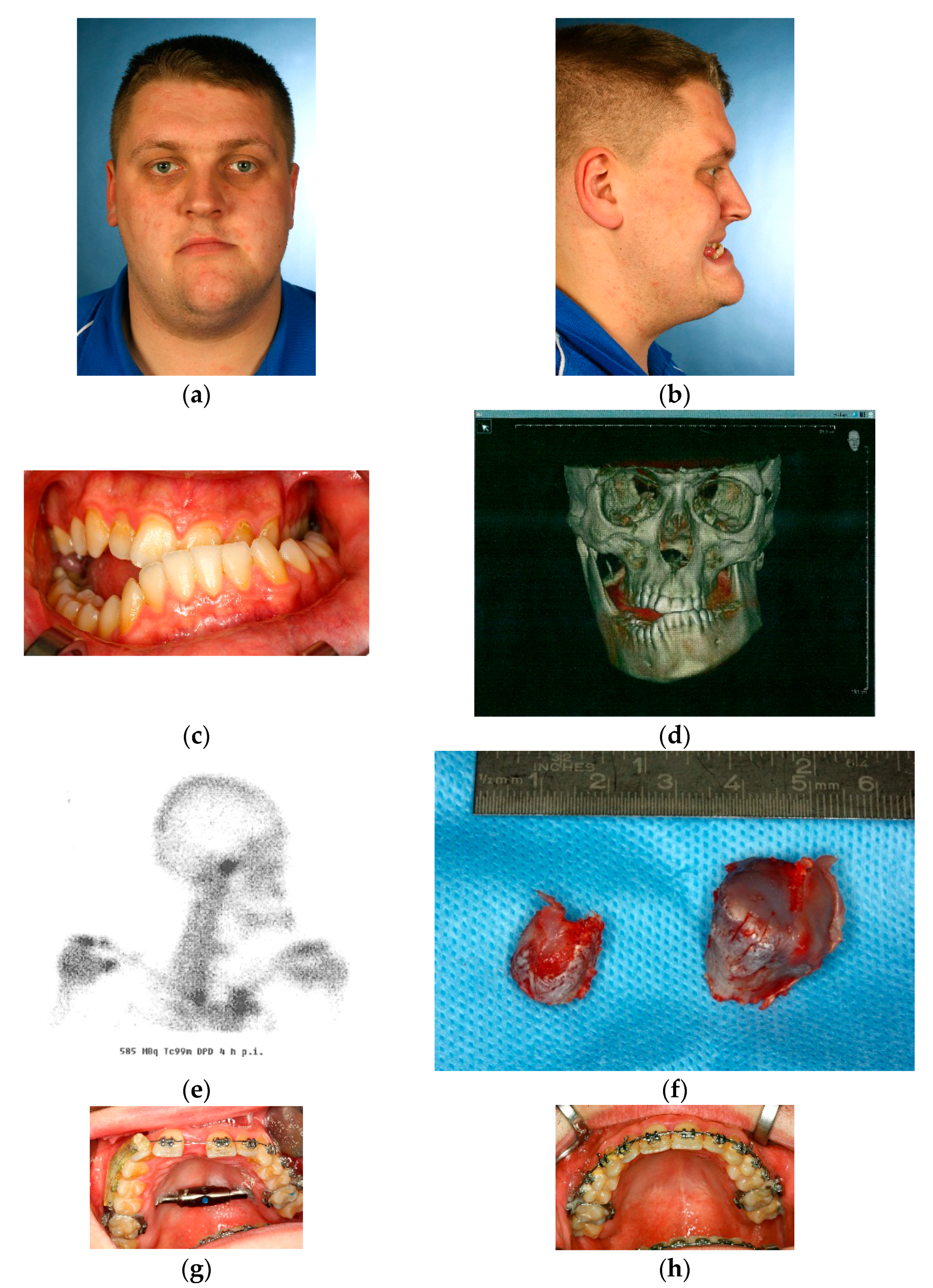 Dentistry 04 00011 g001a