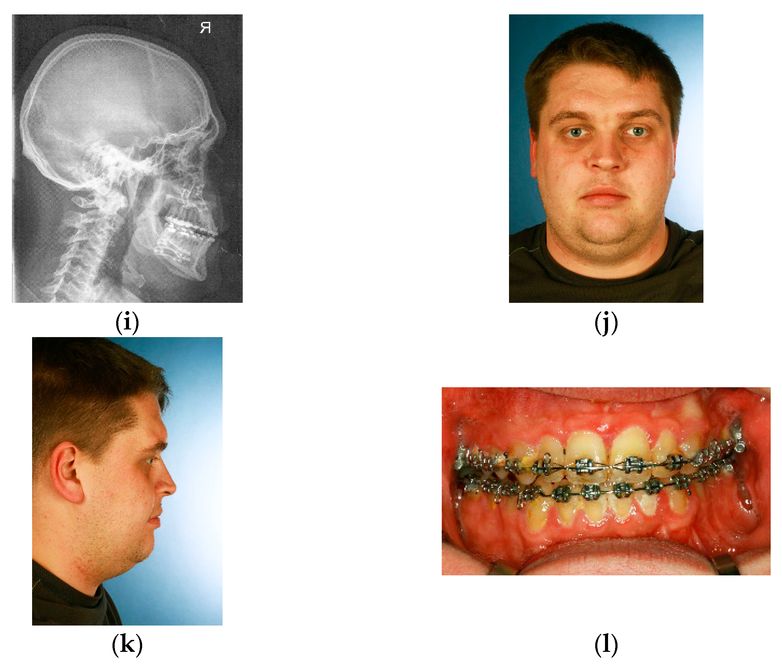 Dentistry 04 00011 g001b