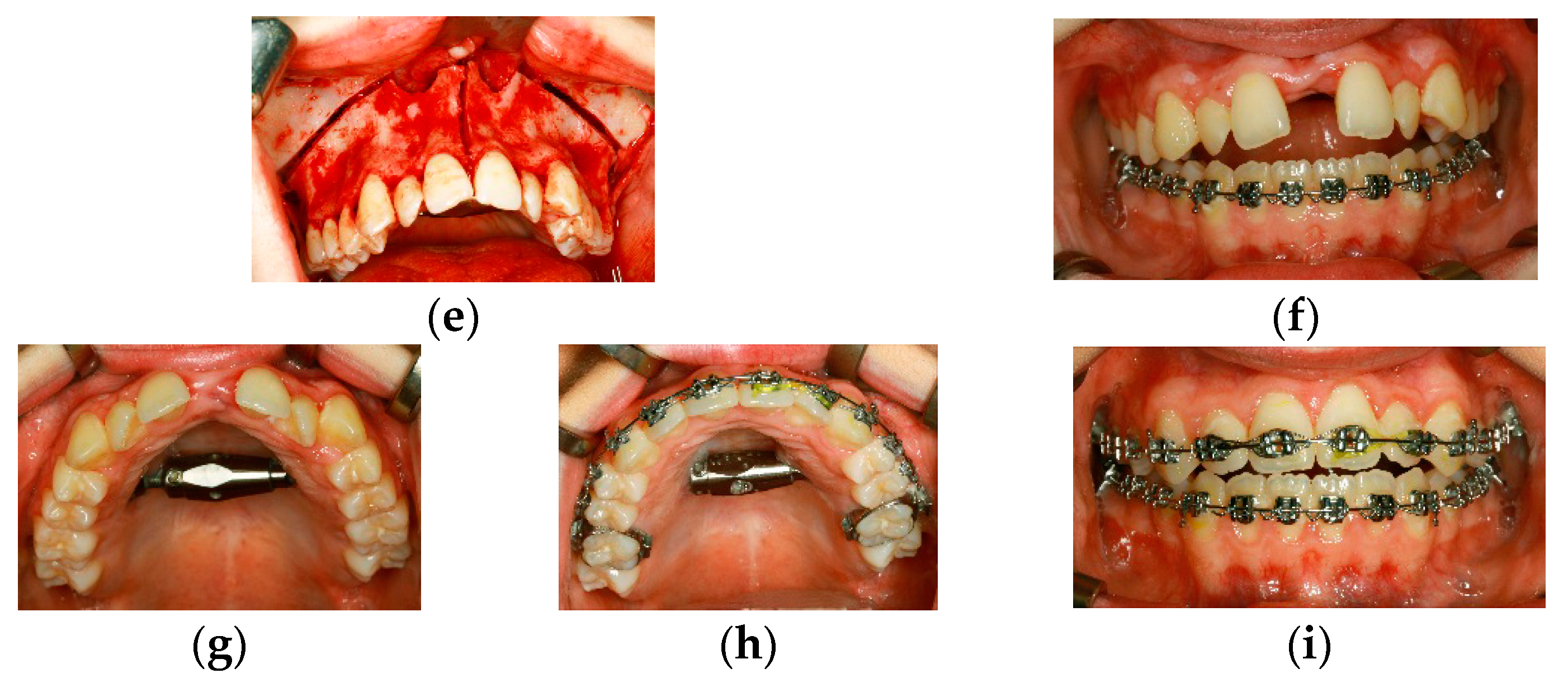 Dentistry 04 00011 g002b