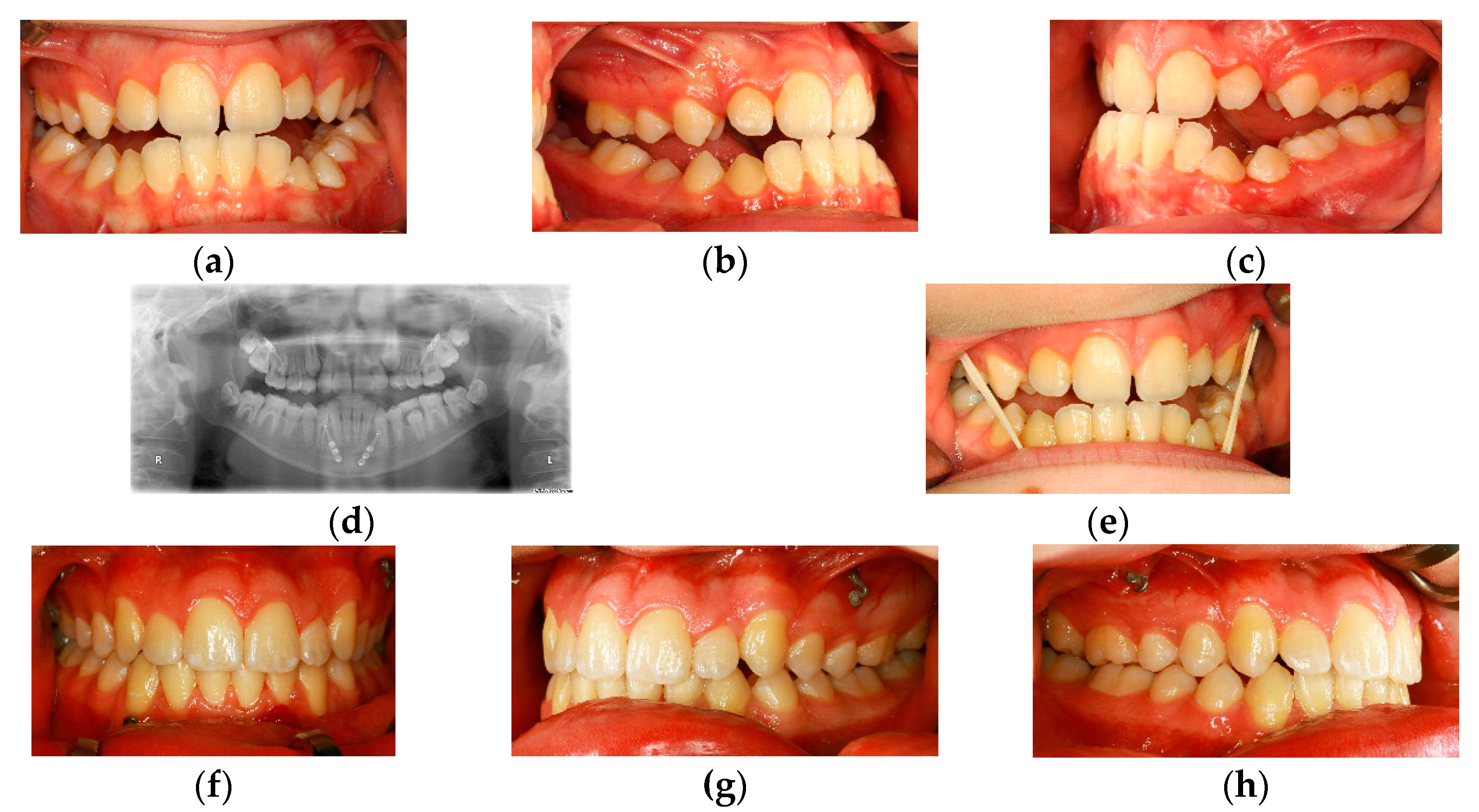 Dentistry 04 00011 g003