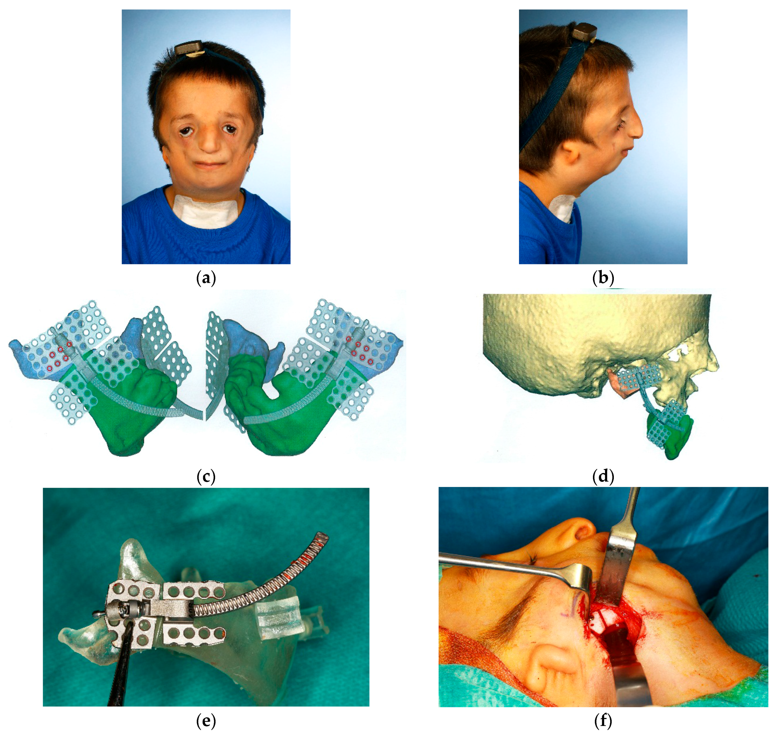 Dentistry 04 00011 g004a