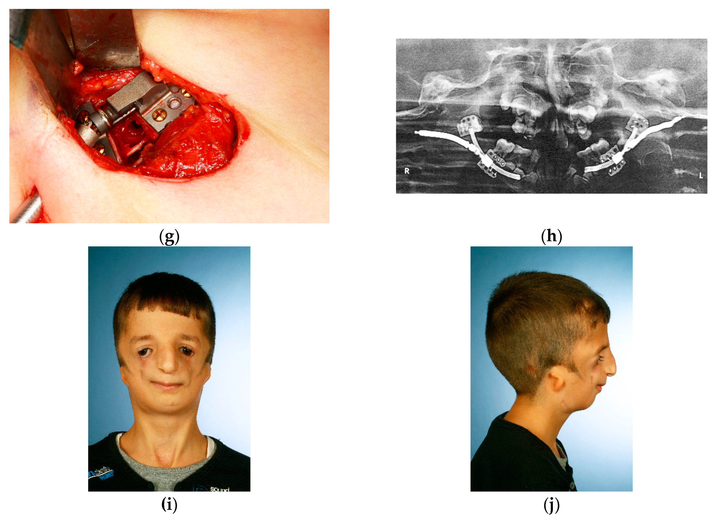 Dentistry 04 00011 g004b