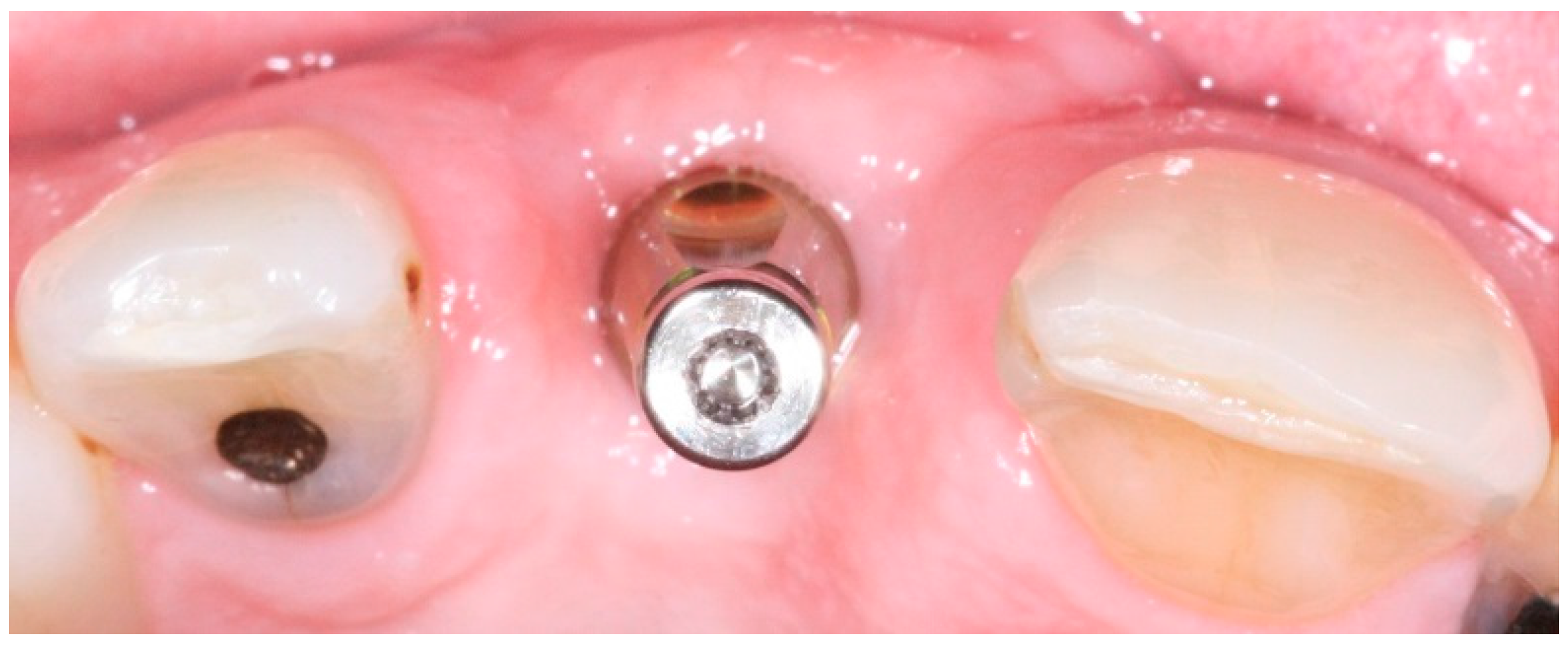 Dentistry 04 00014 g002