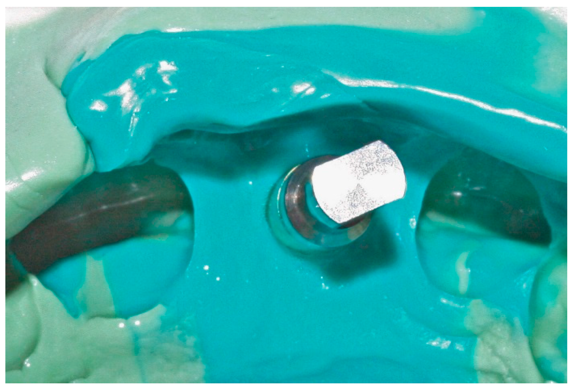 Dentistry 04 00014 g003